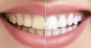 Before After Images Comparison WordPress Plugin – Interactive Image Slider & Visual Comparison Tool